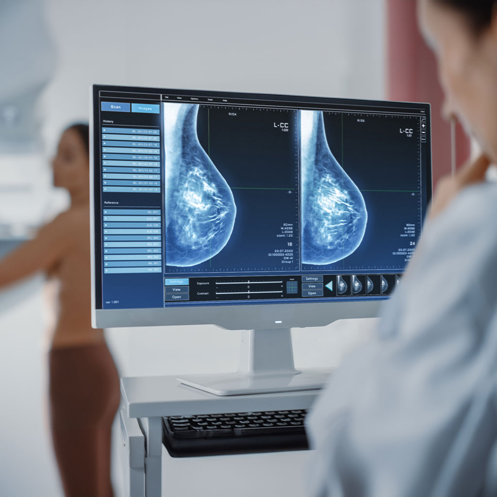 Auffälligkeiten Mammographie
