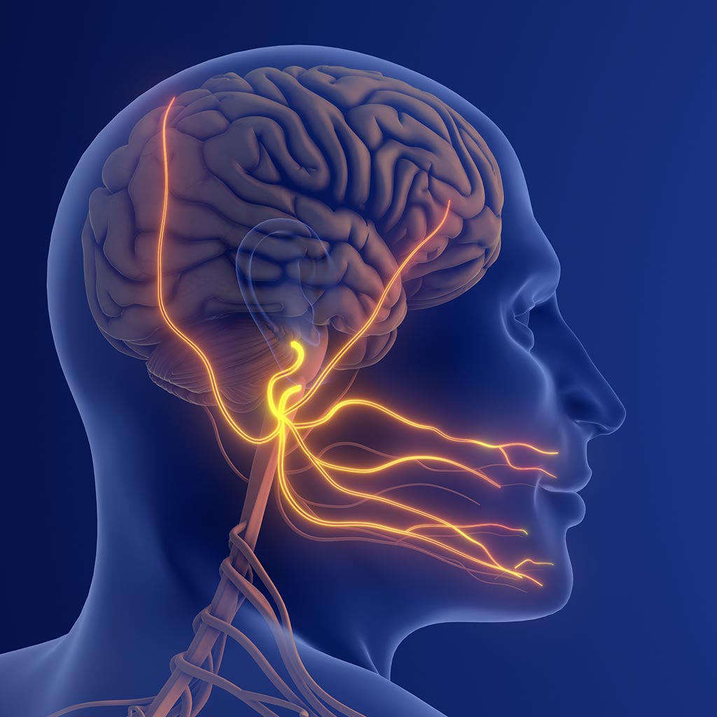 Trigeminusneuralgie nachweisen