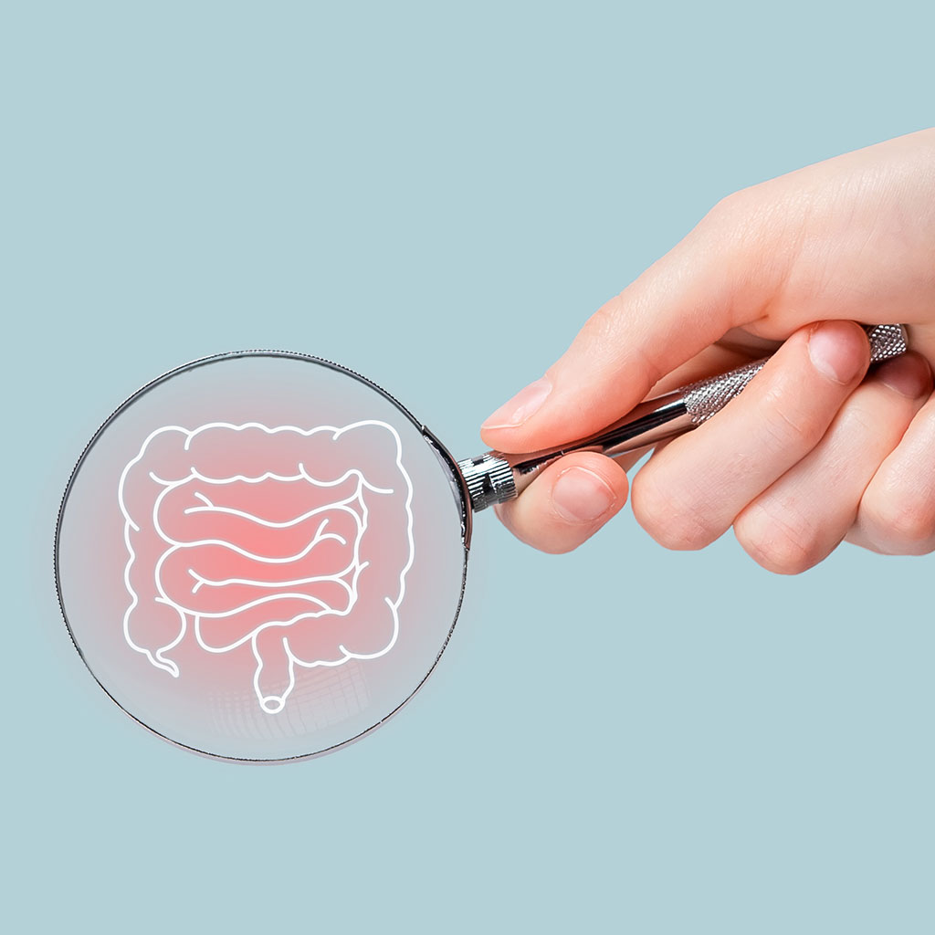 Morbus Crohn erkennen